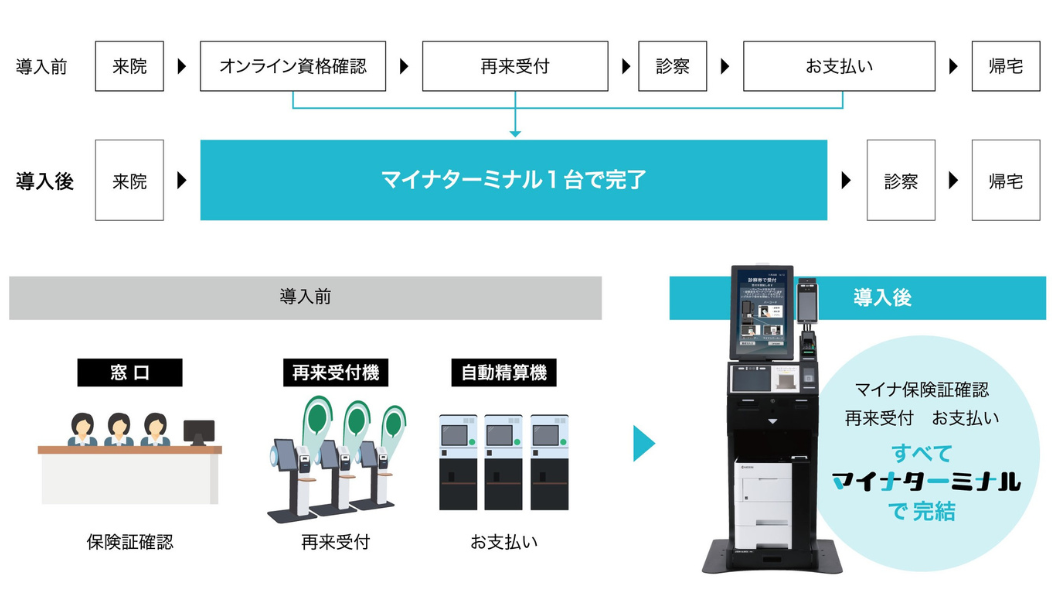 マイナターミナルのメリット